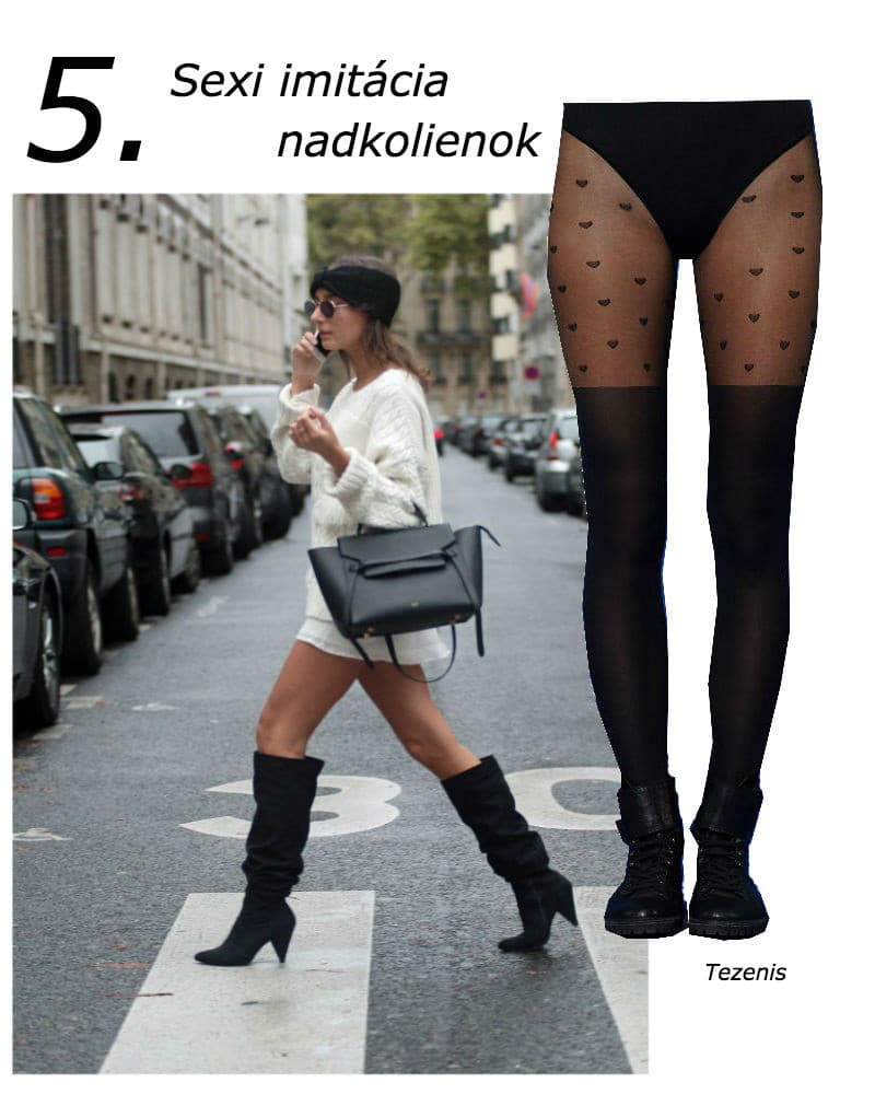 Nadkolienky pôsobia veľmi sexi