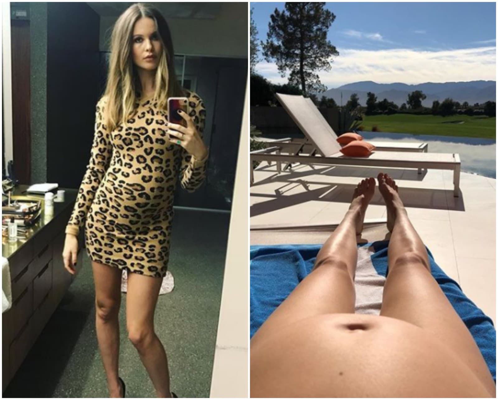 Behati Prinsloo sa už
