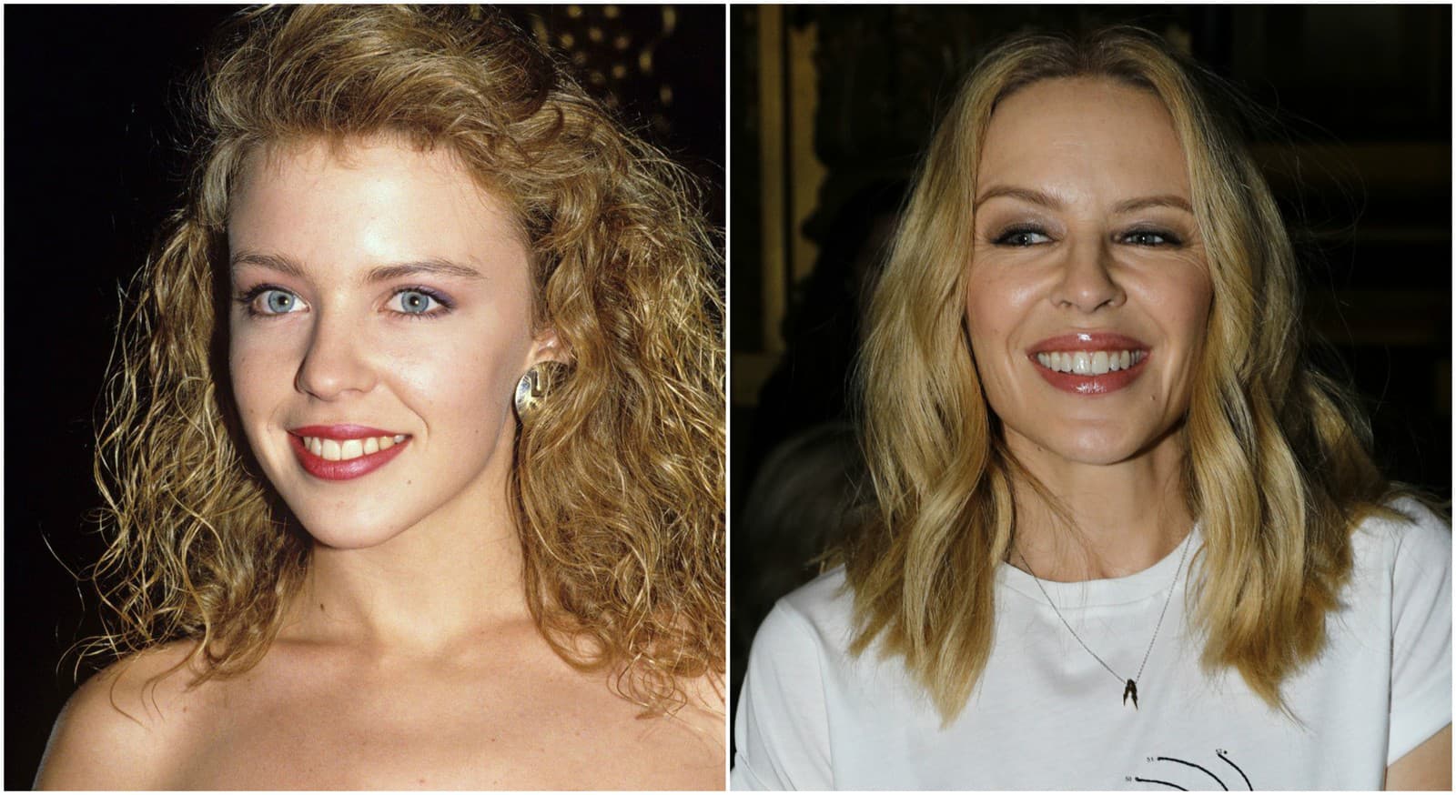 Speváčka Kylie Minogue vyzerá