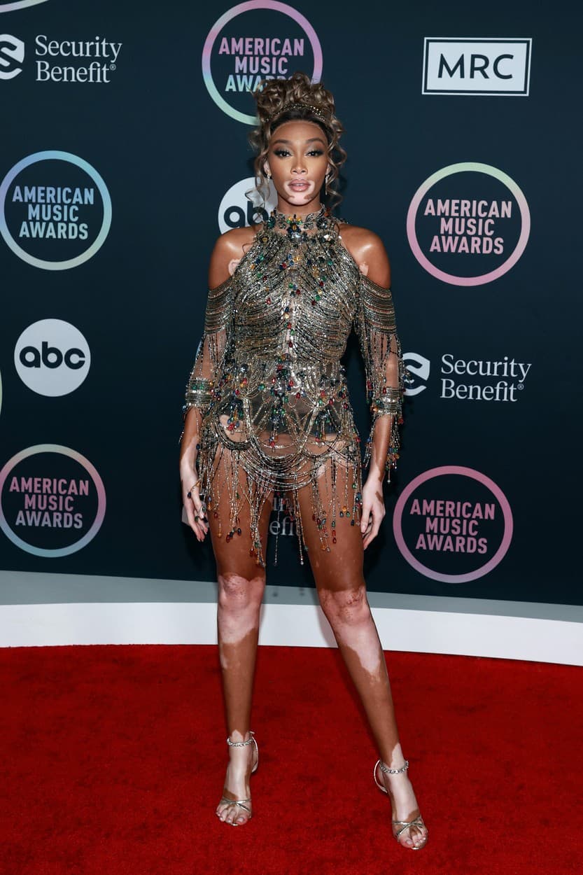 Winnie Harlow predviedla odvážny
