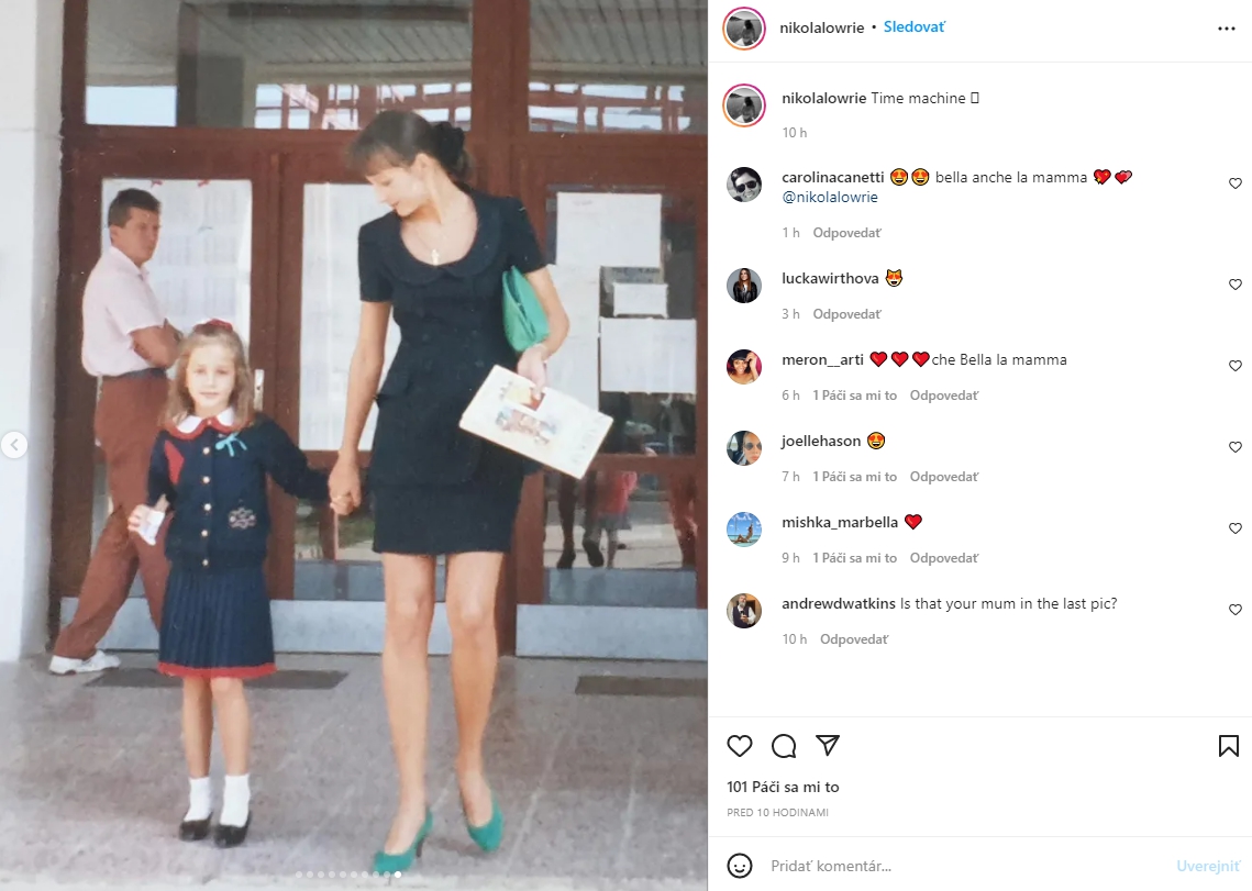Slovenská topmodelka ukázala prekrásne