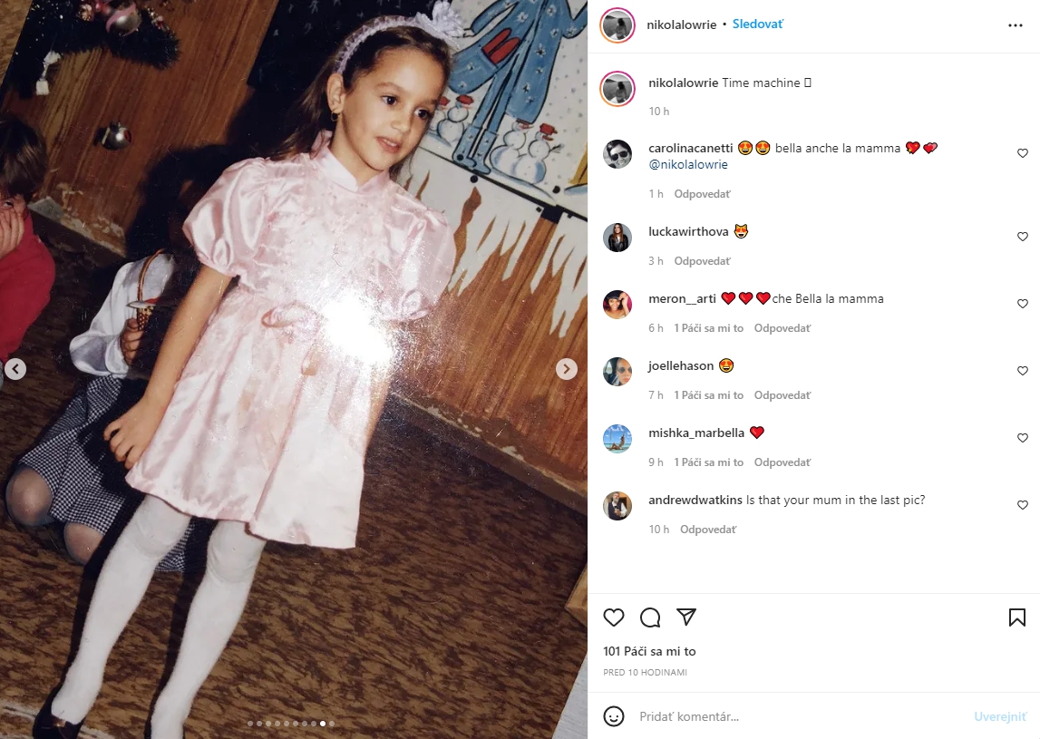 Slovenská topmodelka ukázala prekrásne
