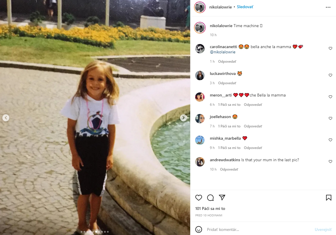 Slovenská topmodelka ukázala prekrásne
