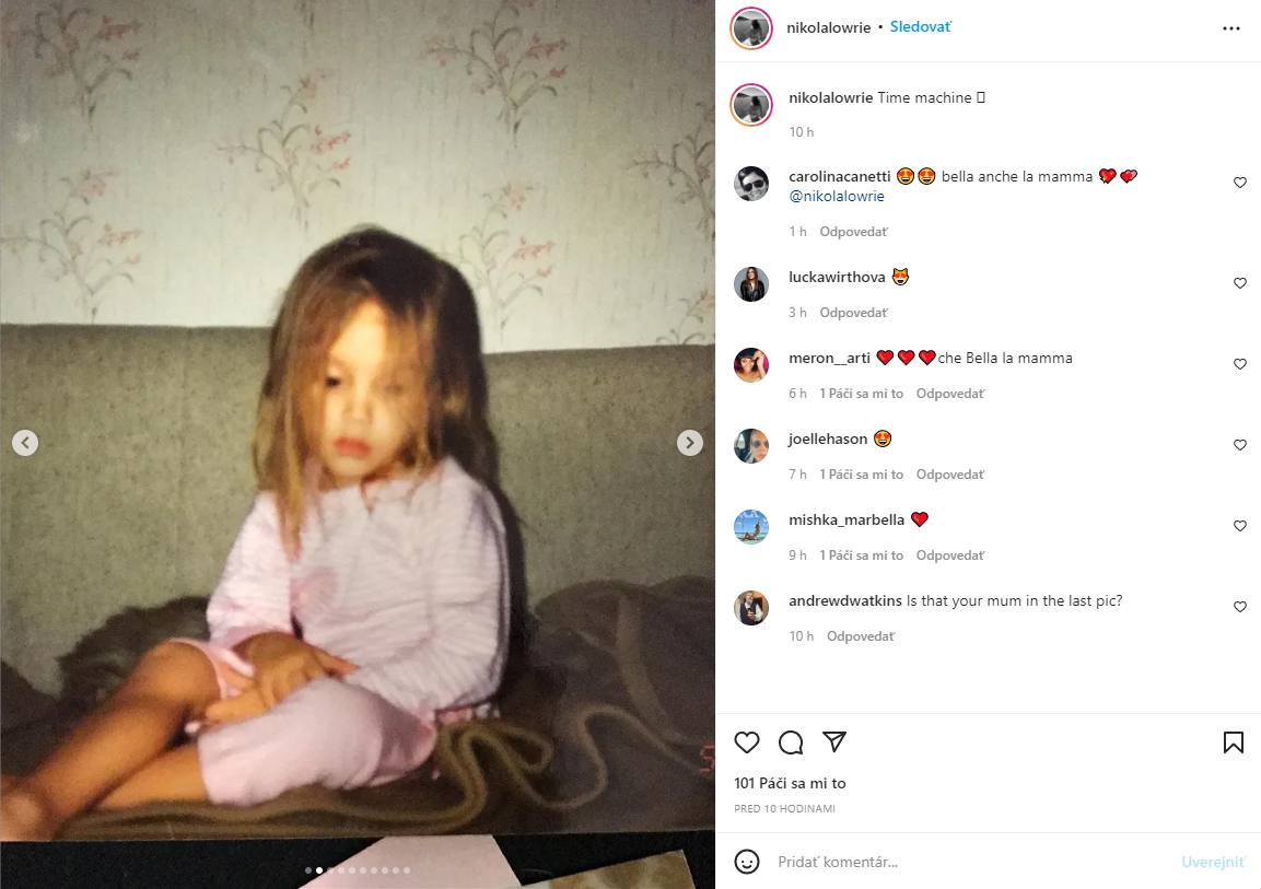 Slovenská topmodelka ukázala prekrásne