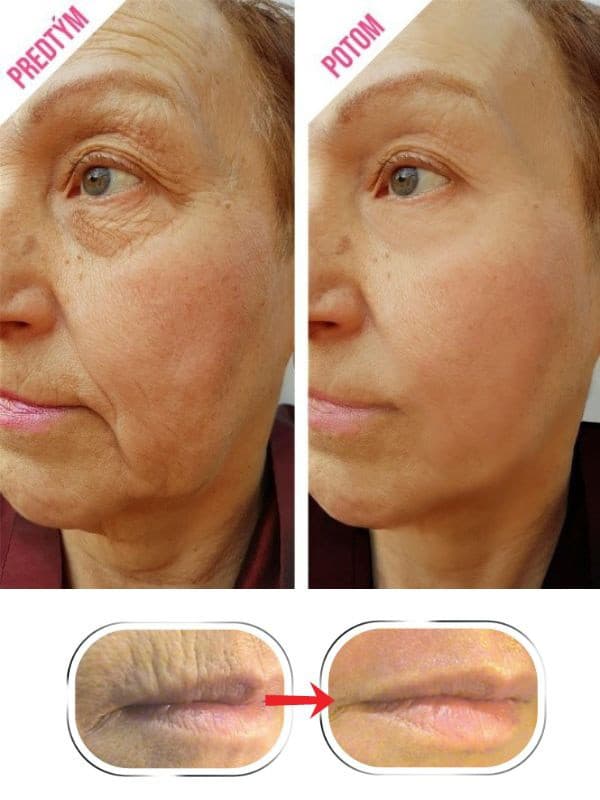 Какой крем от морщин