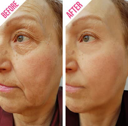 Спасибо этому крему уже