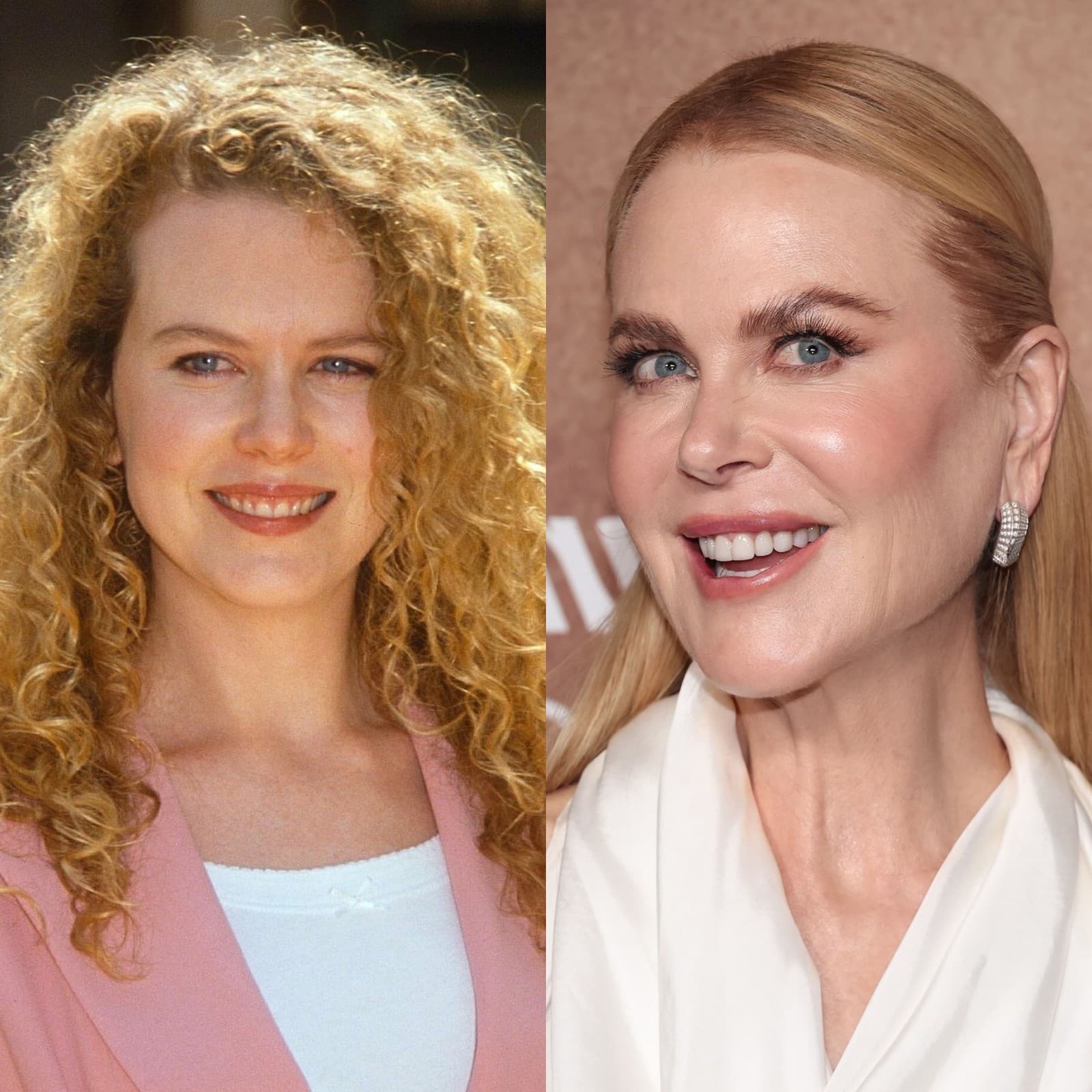 Nicole Kidman sa zmenila