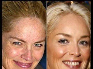 Sharon Stone