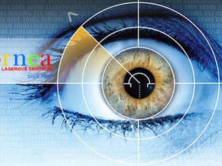 Cornea