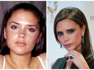 Victoria Beckham si nechala