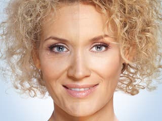 9 z 10 žien