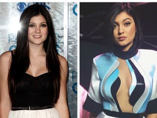 Kylie Jenner prešla naozaj