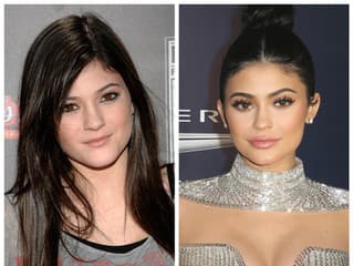Modelka Kylie Jenner pred