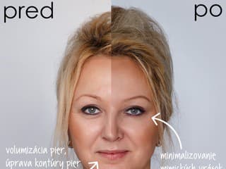 ENVY premenou ku krajšiemu