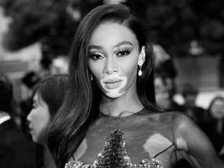 Winnie Harlow rúca tradičné