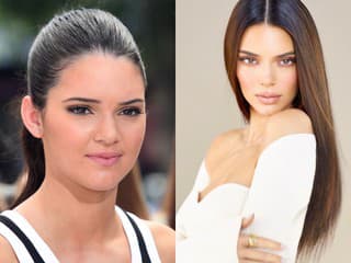 Kendall Jenner pred 10