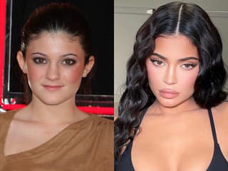Kylie Jenner kedysi a