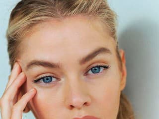 Microneedling ospevuje čoraz viac