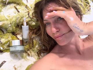 VIDEO: Alexandra Orviská na botox chodí už 20 rokov a vačky pod očami  rozhodne nechce - galéria | Feminity.sk