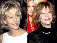 Meg Ryan pred a po plastike