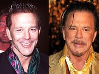 Mickey Rourke pred a po plastike