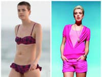 Agyness Deyn pútala vždy pozornosť svojím netradičným vzhľadom, v súčasnosti je z nej jeden 