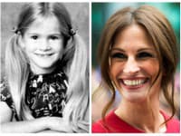 Julia Roberts ako malé dieťa bola terčom posmeškov za jej veľké ústa, strojček na zuby a tiež silné dioptrie
