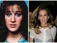 Sarah Jessica Parker podstúpila taktiež estetické zákroky, viď fotografia pred a po