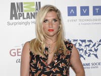 Kesha priznala, že nemá rada samú seba