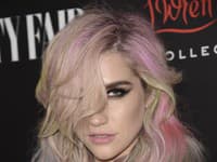 Kesha priznala, že je bojovníkom za sebalásku a sebaúctu