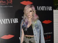 Kesha otvorene priznala svoje problémy
