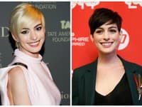 Ani Anne Hathaway by nemala radšej siahať po blond farbe