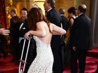 Kristen Stewart musela prísť o barliach, čo jej na elegancii príliš nepridalo