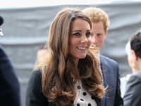 Nos Kate Middleton je najkopírovanejšou plastikou!