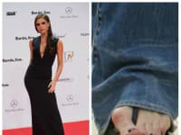 Návrhárka Victoria Beckham doplatila na nepretržité nosenie vysokých topánok. Chodidlá jej hyzdia otlaky, pľuzgiere a zdeformované kosti.