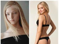 Takto vyzerala Alena Shishkova pred plastickými operáciami.