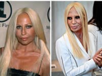 Donatella Versace momentálne vyzerá najhoršie ako kedy vyzerala., ZDROJ: Profimedia, SITA