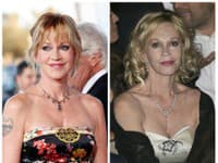 Melanie Griffith si plastikami zdevastovala tvár