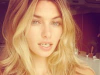 Jessica Hart má povestnú medzierku medzi zubami
