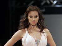 Málokto vie, že aj ruská topmodelka Irina Shayk mala pôvodne úplne úzke pery