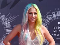 Kesha zažila niečo, čím sa môže pochváliť iba minimum ľudí