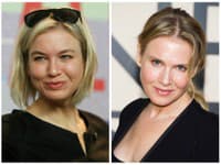 Reneé Zellweger čelí ostrej kritike za svoj nový look