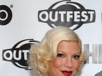 Tori Spelling kvôli manželovi podstúpila plastické operácie