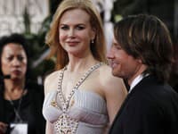 Nicole Kidman je podľa mnohých kritikov na nepoznanie: Bojí sa starnúť?