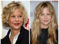 Tvár Meg Ryan nadobudla vďaka zákrokom komický úškľabok