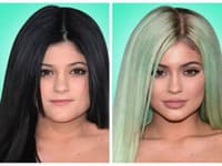 Kylie Jenner síce priznala výplne pier, no špekuluje sa aj o brade
