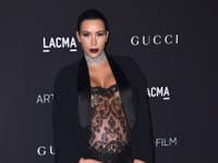 Príliš veľa Kim je vždy zraku škodlivé