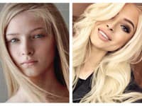 Alena Shishkova má obrovský vplyv na ľudí a hoci táto bondínka vyzerala aj predtým veľmi dobre, zrejme jej to nestačilo