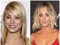 Hviezda seriálu Teória veľkého tresku, Kaley Cuoco, si tiež ľahla pod nôž