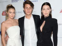Anwar Hadid je novou modelingovou hviezdou. Ako sa vám páči? 